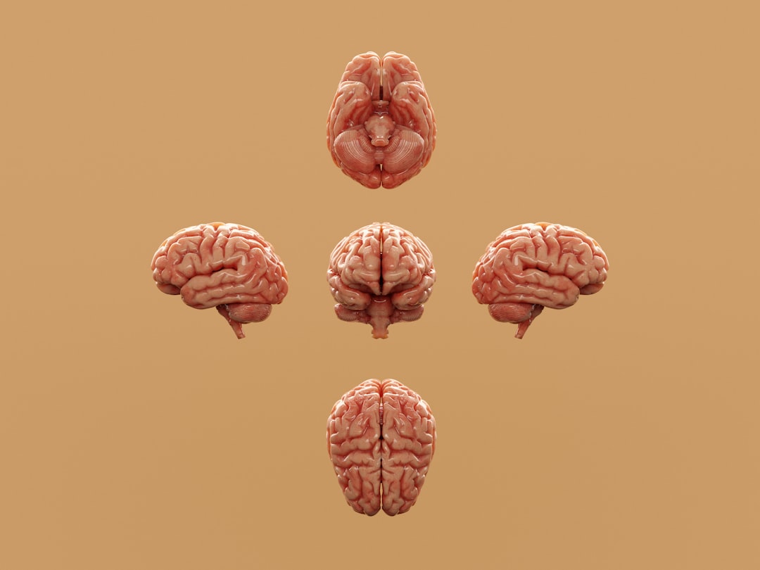 Exercise reduces blood pressure after stroke or TIA: systematic review and meta-analysis